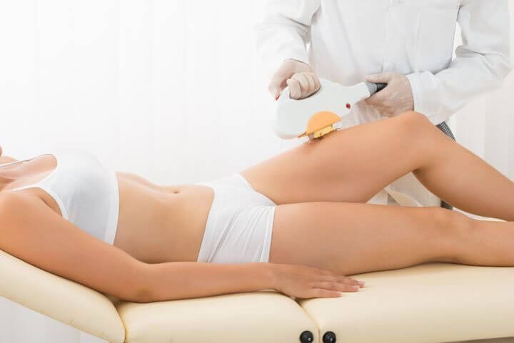 How Laser Hair Removal Works